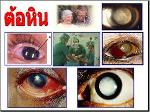 ดี คอนแทค D CONTACT (สมัครสมาชิก)